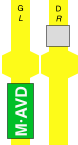 M·AVD