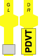 PDVT